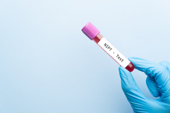 Blood sample tube with NIPT or Non Invasive Prenatal Testing label. Genetic screening for pregnant women which estimates risk of fetus having Down syndrome or other genetic diseases.