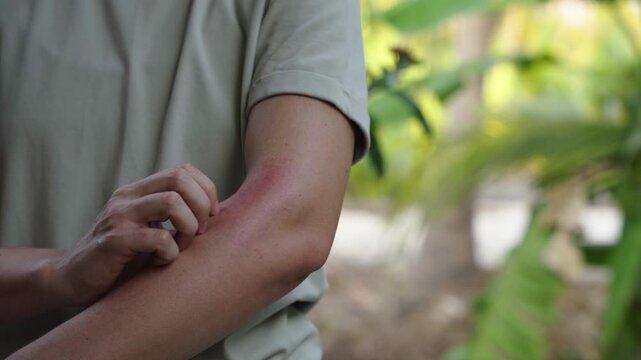 Woman scratching irritated skin on arm, allergy and itching concept