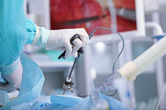 Laparoscopic instruments in the hands of a surgeon. Minimally invasive surgery. Surgical intervention through small punctures in the abdominal cavity. A team of surgeons. Modern abdominal surgery.