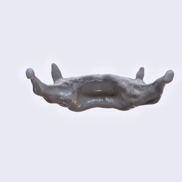 Illustration of the hyoid bone showing structure, position in the neck, and anatomical details.