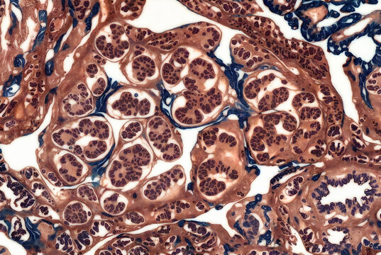 This is a microscopic image of pancreatic tissue, likely showing acinar cells and ducts.