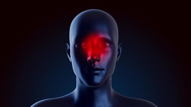 3D medical animation of human face in front view with glowing red area over nose and sinus cavities. Visualization effectively represents sinus pressure, nasal congestion, allergic rhinitis