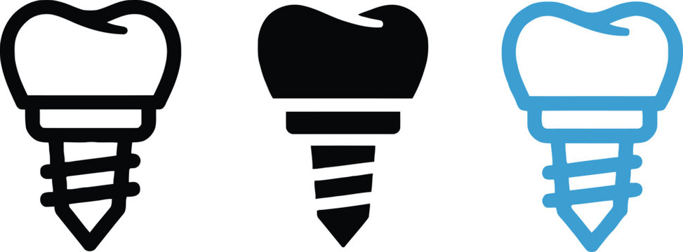 Dental implants three stages of illustration black grey and blue