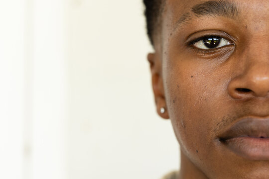 African man in his 20s gazing, showing stud earring and textured skin in studio