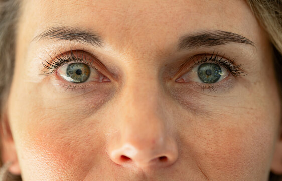 Vertical video: Woman receiving window light, showing eye reflection and skin pores for skincare