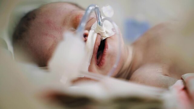 Closeup lovely little newborn baby infant lying in incubators for newborns, Newborn baby having the the breathing problem after birth, newborn in NICU, Neonatal intensive care unit.