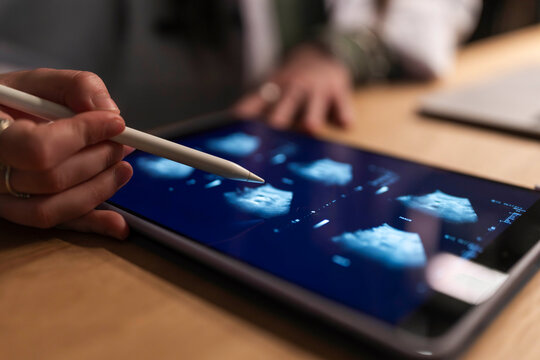 A medical professional uses a stylus to examine ultrasound images on a tablet, reviewing patient data for diagnosis and treatment planning.