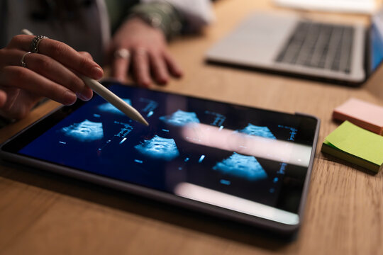 A medical professional uses a stylus to examine ultrasound images on a tablet, with a laptop and sticky notes on the desk.