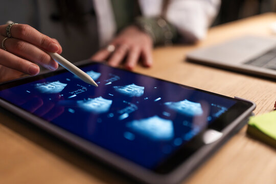 A medical professional uses a stylus to examine ultrasound images on a tablet, with a laptop in the background.