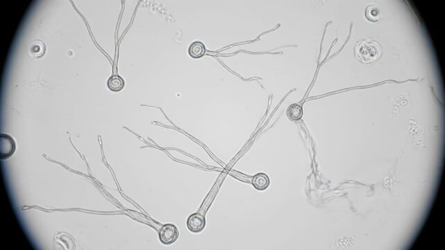Microscopic view of germinating fungal spores under a microscope.