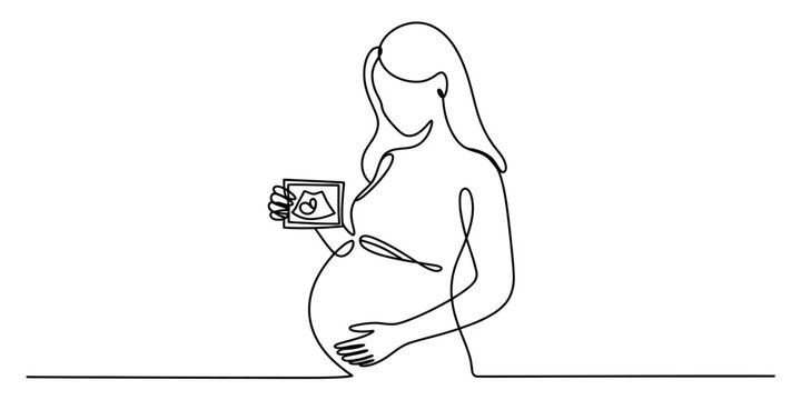 Continuous line drawing of a pregnant woman holding a sonogram of her unborn baby with happiness Vector, illustration