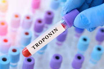 Obraz premium Doctor holding blood sample tube with troponin test in medical laboratory, cardiac diagnostics and acute heart condition concept