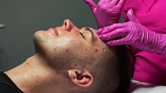 A young man is lying on a treatment table in a skincare clinic. A beautician is applying a mask to his face while wearing pink gloves. The setting is well-lit, focusing on skincare.