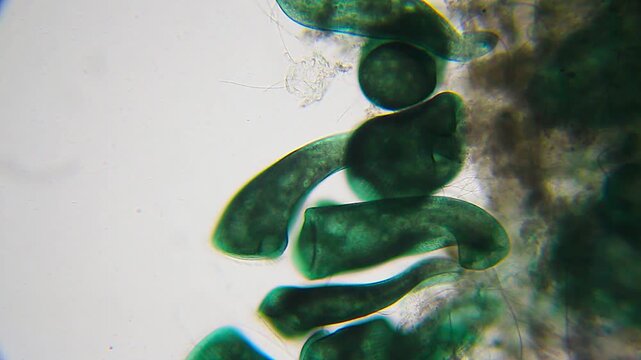 Stentor ciliates with extended trumpet-shaped bodies under 100x brightfield microscopy. 4K scientific microscopy footage.