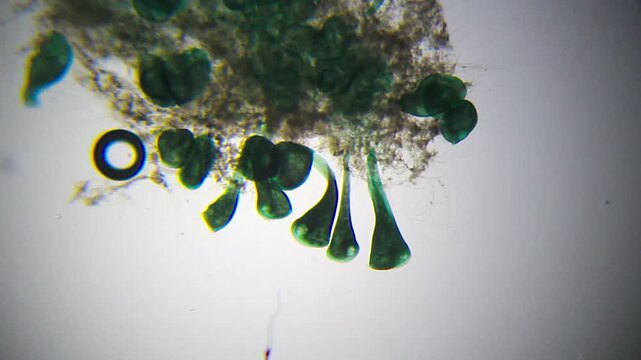Stentor ciliates attached to detritus under 40x brightfield microscopy. 4K scientific microscopy footage.