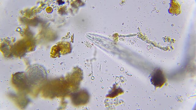 Nematode anterior region with visible stylet among detritus under 400x brightfield microscopy. 4K scientific microscopy footage.