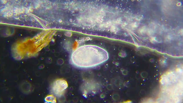 Ciliate with visible cilia and vacuole pulsation near oligochaete under 40x darkfield microscopy. 4K scientific microscopy footage.