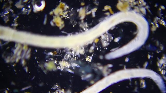 Active oligochaete worms with rotifers in fluid environment under 40x darkfield microscopy. 4K scientific microscopy footage.