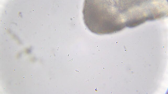 Oligochaete worm with surrounding bacteria in fluid environment under 400x brightfield microscopy. 4K scientific microscopy footage.