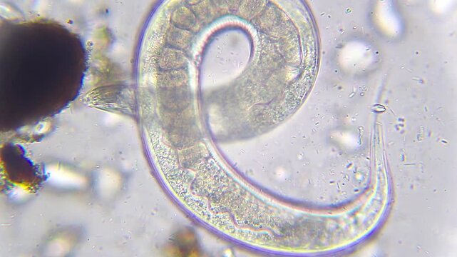 Coiled nematode with visible eggs and digestive tract near detritus under 400x brightfield microscopy. 4K scientific microscopy footage.
