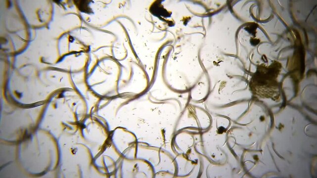 Dense aggregation of nematodes moving among dark detritus fragments under 40x brightfield microscopy. 4K scientific microscopy footage.