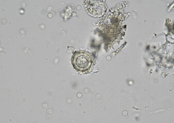 soil microorganisms under a microscope including amoeba, flagellates, nematodes, fungi, bacteria  © ADP