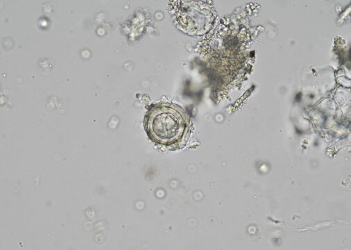 soil microorganisms under a microscope including amoeba, flagellates, nematodes, fungi, bacteria	