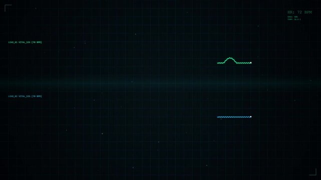 Abstract digital electrocardiogram display showing heart rhythm, medical data visualization, futuristic technology, science background