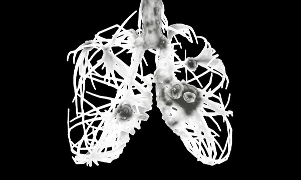 Human lungs and viral infections, pneumonia, and cancer gene mutations