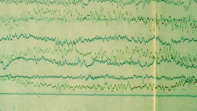 Seismograph Record of an Earthquake on old paper, EEG of the patients problems in the electrical activity of the brain