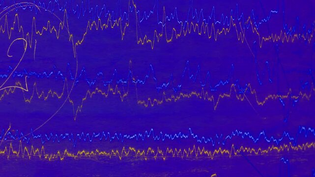 Seismograph Record of an Earthquake on old paper, EEG of the patients problems in the electrical activity of the brain