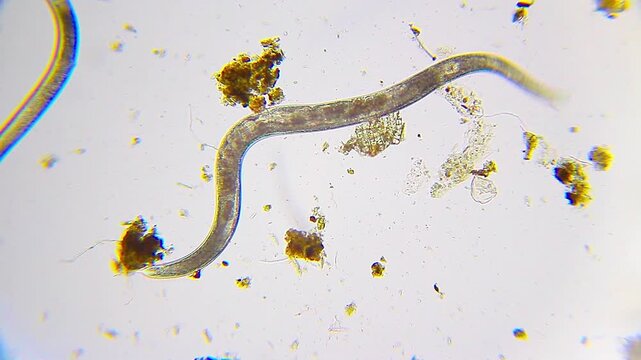 Single nematode with visible internal organs among detritus under 100x brightfield microscopy. 4K scientific microscopy footage.