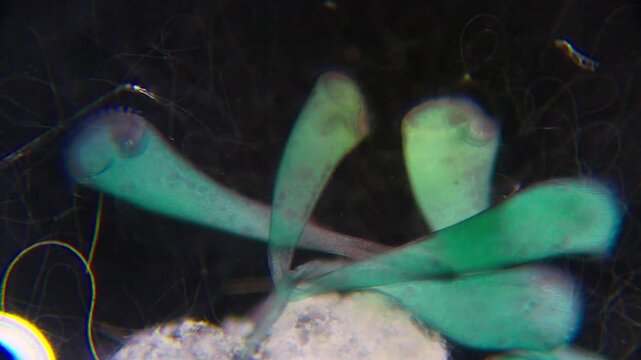 Stentor ciliates attached to substrate with extended bodies under 100x darkfield microscopy. 4K scientific microscopy footage.