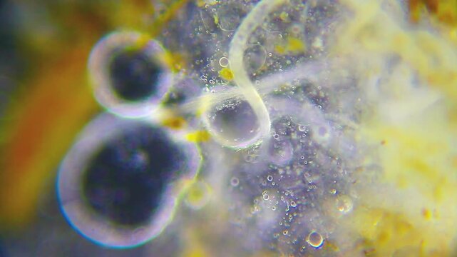 Nematodes moving within light detritus material under 100x darkfield microscopy. 4K scientific microscopy footage.
