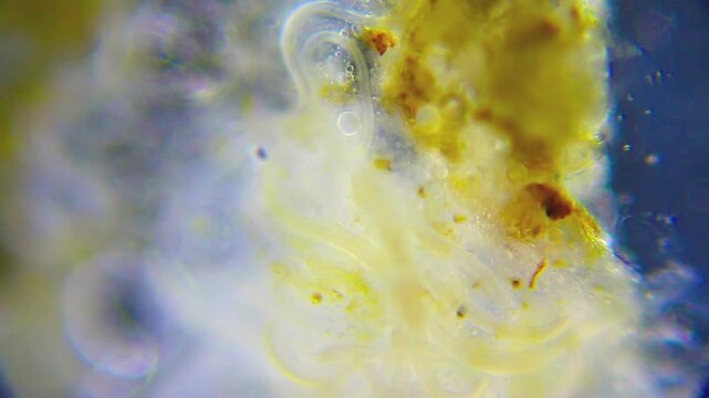 Intertwined nematodes exhibiting active movement within detritus under 100x darkfield microscopy. 4K scientific microscopy footage.