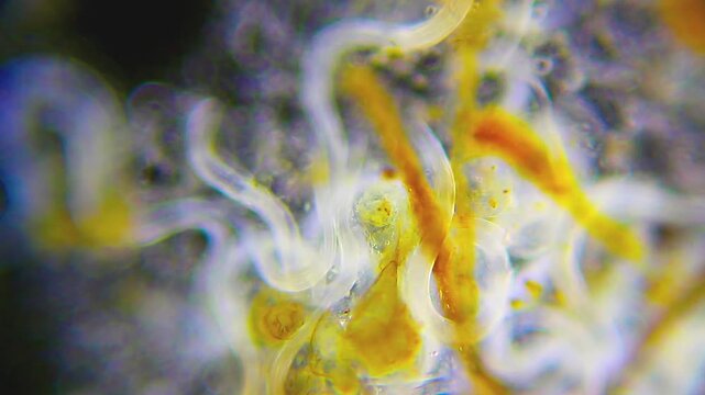 Nematodes moving within dense detritus mass under 100x darkfield microscopy. 4K scientific microscopy footage.