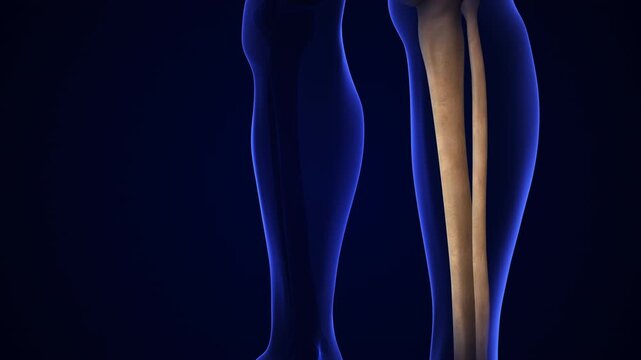 Broken Fibula Bone Pain Anatomy Medical Concept