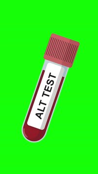 ALT Blood Test Tube Animation on Green Screen Background, Alanine Aminotransferase Test, Liver Enzyme Test, Medical Lab Sample, Healthcare Laboratory Concept