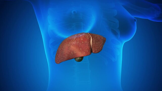 Female healthy liver turning into a fatty liver