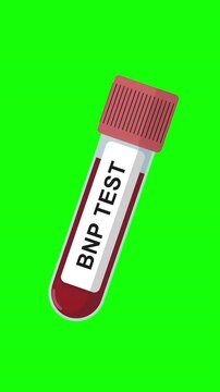 BNP Blood Test Tube Animation on Green Screen Background, Brain Natriuretic Peptide Test, Heart Failure Marker Test, Medical Lab Sample, Healthcare Laboratory Concept