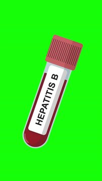 Hepatitis B Blood Test Tube Animation on Green Screen Background, HBV Screening Test, Liver Infection Test, Medical Lab Sample, Healthcare Laboratory Concept
