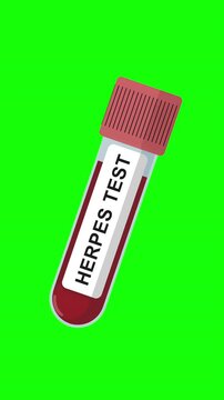 Herpes Blood Test Tube Animation on Green Screen Background, HSV Screening Test, Medical Lab Sample, Healthcare Laboratory Concept