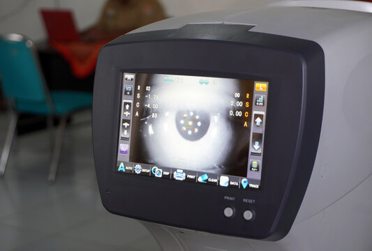 Close up of an autorefractor machine screen in an optical clinic. Professional ophthalmic equipment for eye examination and vision testing. Modern medical technology for healthcare concept.