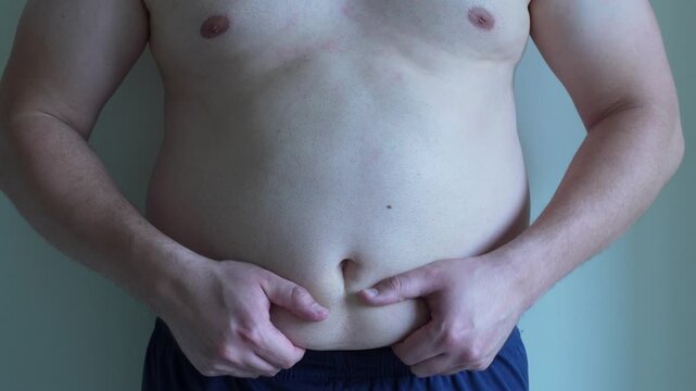 Close-up of a man's hands and his large belly. He is patting and grabbing his belly, symbolizing an unhealthy lifestyle. Man with a potbelly. White man