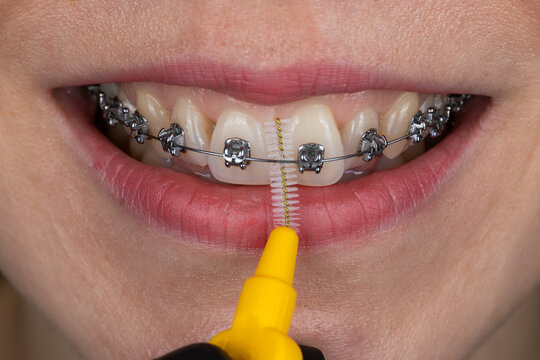  Dental hygiene concept