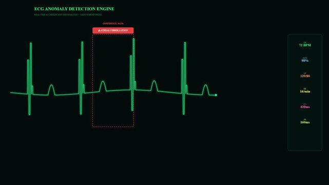 Advanced AI diagnostic algorithms power a real-time ECG anomaly detection engine, meticulously monitoring cardiac rhythm for critical health insights on a digital display.