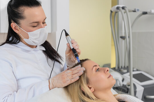 Alopecia. Woman hair loss improve growth treatment regeneration, dermapen microneedling, vitamin injections. Trichologist cosmetologist doctor head scalp procedure, fractional microneedle mesotherapy.