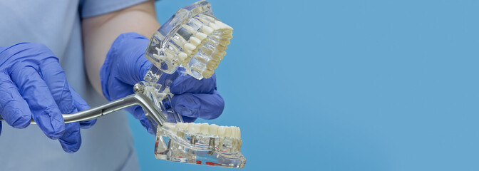 Close Up of Dentist Demonstrating Dental Implant Model with Instrument