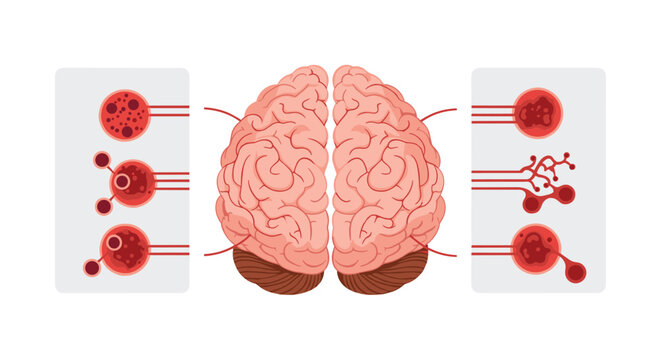 A detailed medical illustration displays a human brain in pink tones with several red circular callouts highlighting various microscopic neurological and cellular structures.