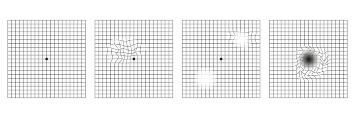 Set of amsler grid, medical test © Tatiana
